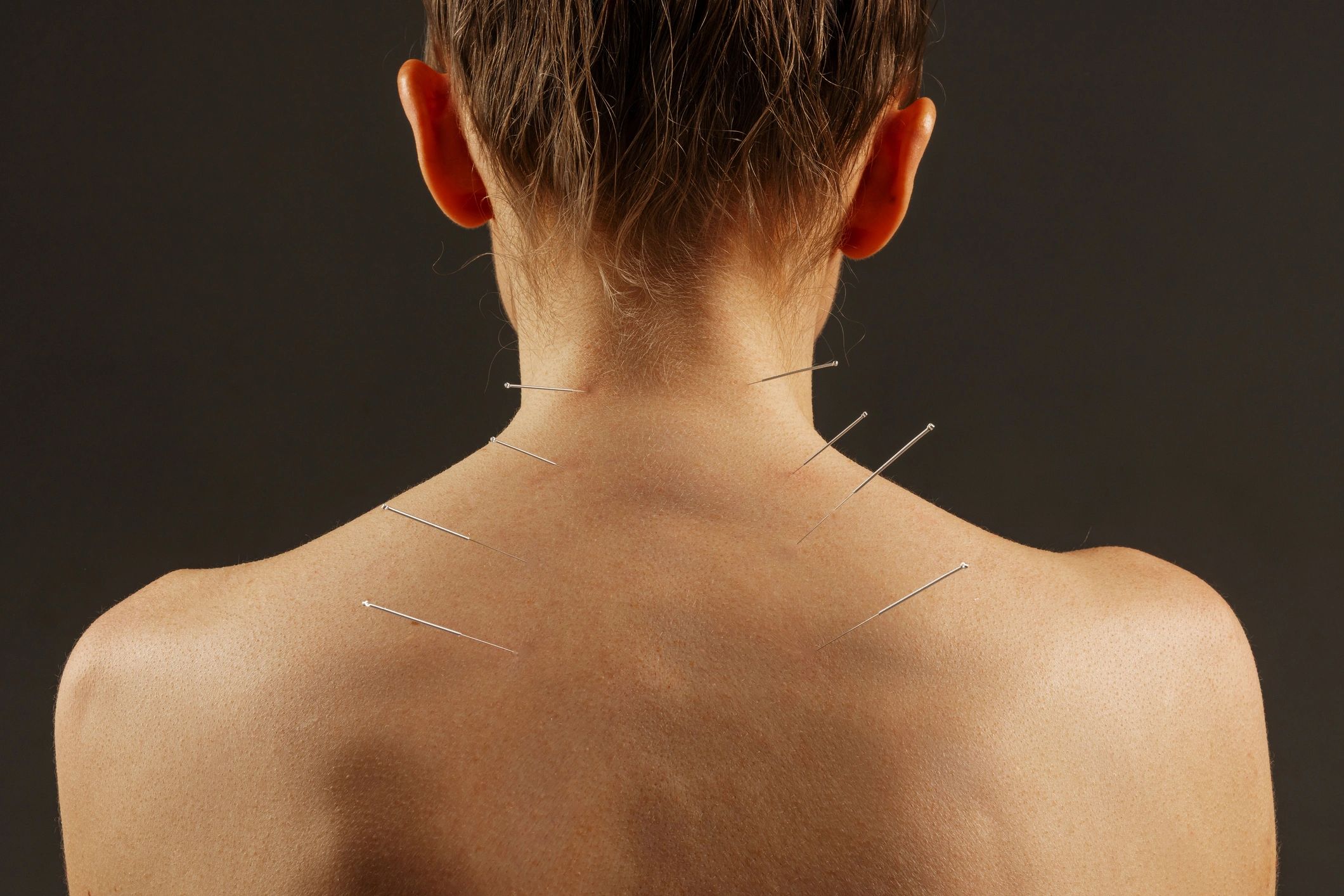 acupuncture treatment clinic